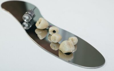 When is it Time for Dental Implants? A Comprehensive Guide