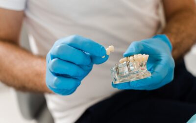 Are Dental Implants Worth It? A Complete Guide for Mesquite Residents