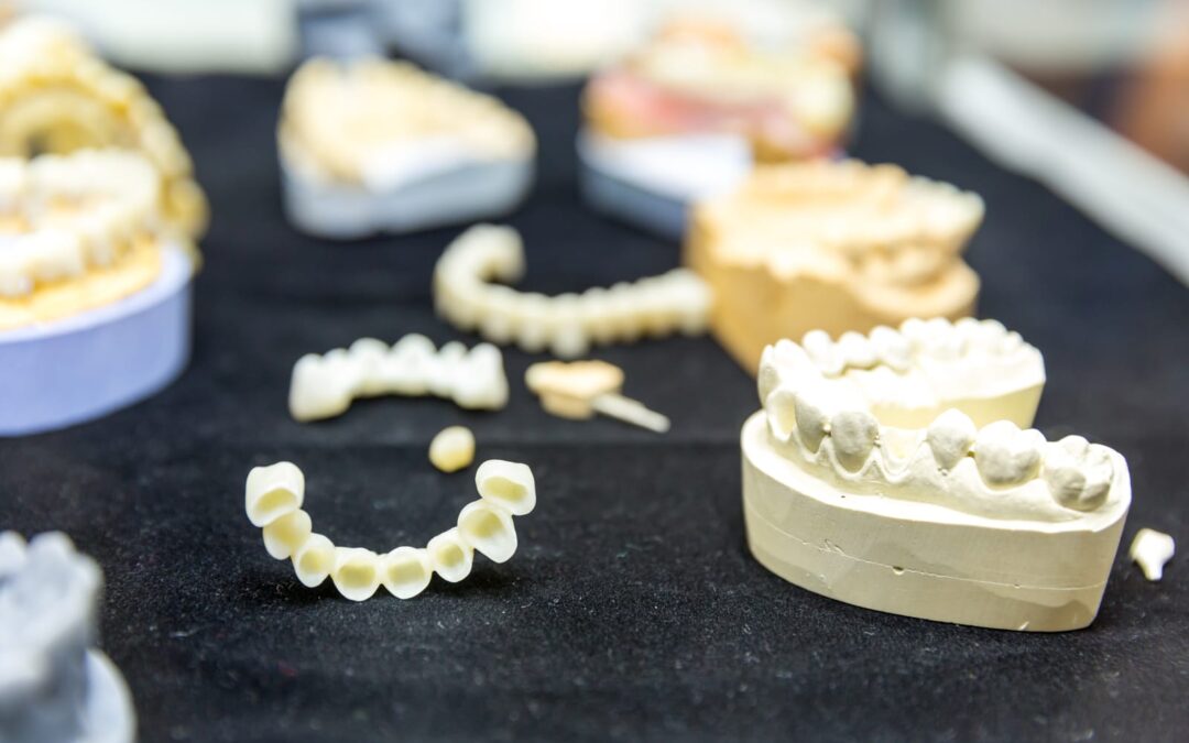 Missing Teeth? Why Fall is the Best Time for Dental Implants in St. George