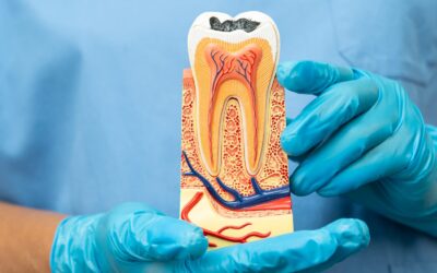 Is a Root Canal Painful? St. George Dentist Answers Common Questions