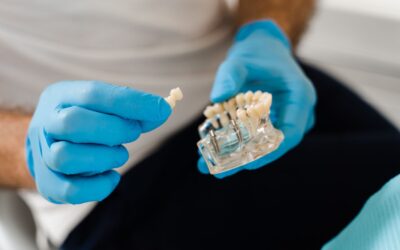 How Long Do Dental Implants Last? St. George Implant Dentist Explains