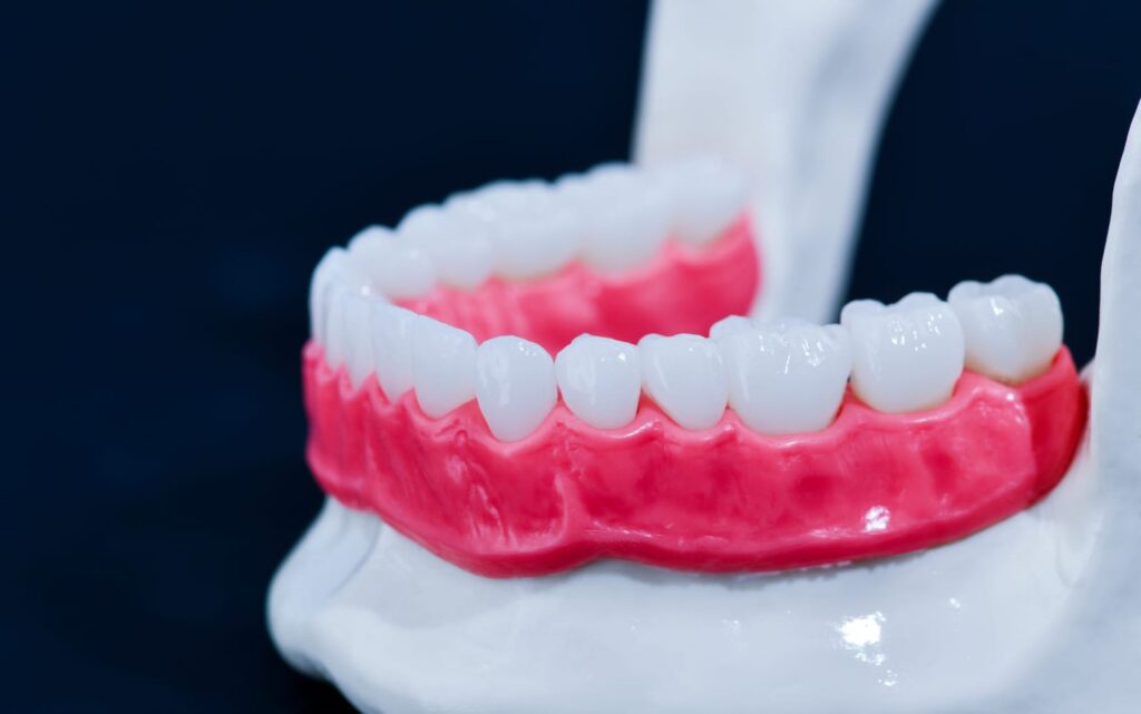 Dental Implants vs Dentures: Which Is Right for You?