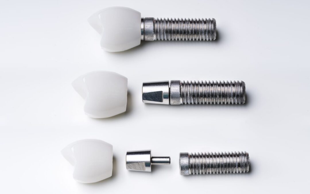 Cost of Dental Implants in St. George, Utah | Utah Dental Center