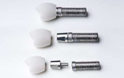How Much Do Dental Implants Cost in St. George, Utah?