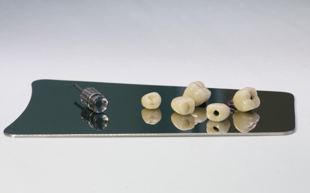 Step-by-Step: How the Dental Implant Procedure Works