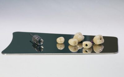 Step-by-Step: How the Dental Implant Procedure Works