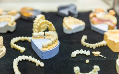 Dental Implant Recovery Timeline: What St. George Patients Need to Know