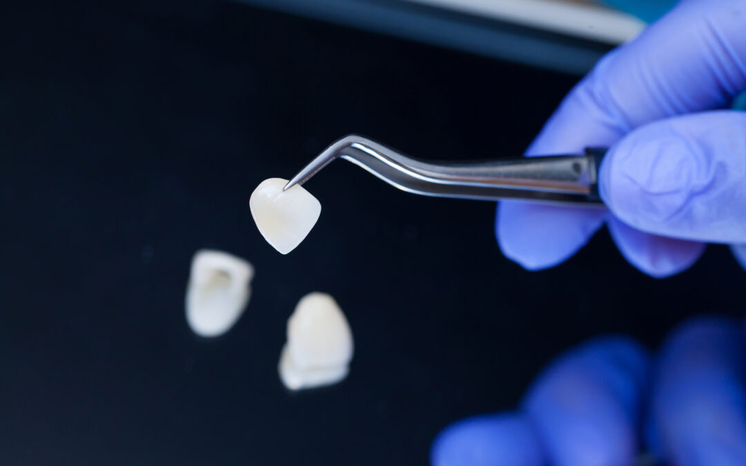 How Much Does a Dental Crown Cost in St. George, UT?