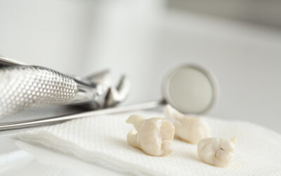 How Much Does a Tooth Extraction Cost in St. George? A Complete Pricing Guide