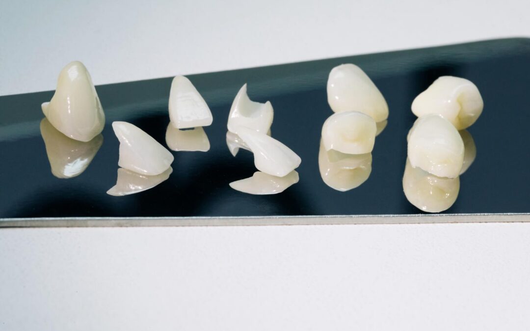Composite Veneers vs. Porcelain Veneers: Which Is Right for Your Smile?