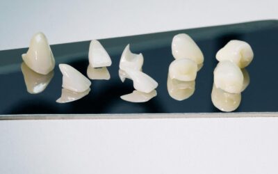Composite Veneers vs. Porcelain Veneers: Which Is Right for Your Smile?