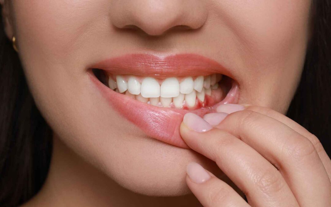 Why Do My Gums Hurt but Not Bleed_ Possible Causes and When to Get Checked